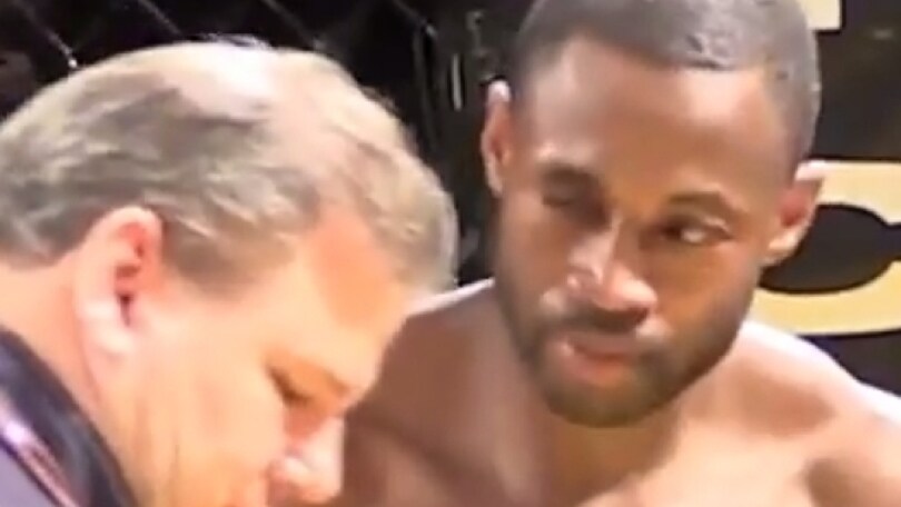 Perde occhio di vetro durante un incontro di MMA