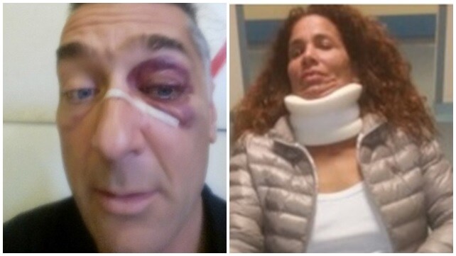 Torino-Juventus, insulti razzisti e rissa al derby dei Pulcini