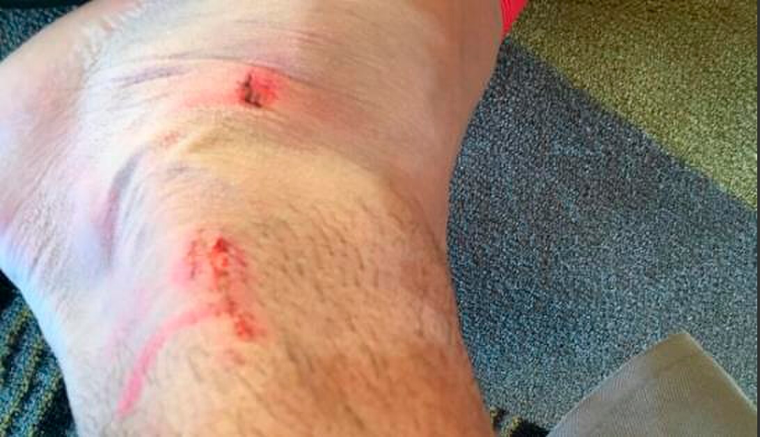 Euro 2016, Khedira mostra la caviglia malconcia dopo la Polonia
