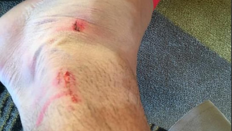 Euro 2016, Khedira mostra la caviglia malconcia dopo la Polonia