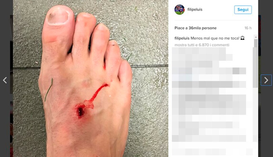 Liga, Filipe Luis contro Suarez: pubblica la foto della ferita