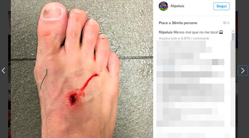 Liga, Filipe Luis contro Suarez: pubblica la foto della ferita
