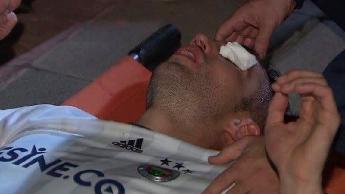 Van Persie, che spavento! Adesso rischia di perdere la vista da un occhio