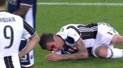 Juventus-Lazio, paura per Mandzukic: sanguina in campo