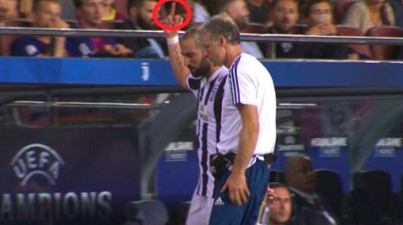 Higuain, dai tifosi un "vaffa" alle critiche. Ma qualcuno lo pungola