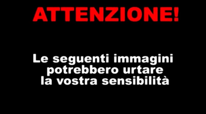 Nba, infortunio shock per Hayward: frattura di tibia e caviglia