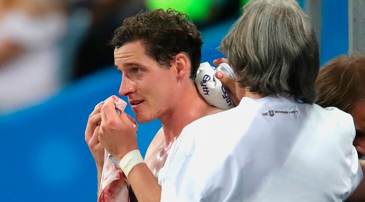 Germania, Rudy operato al naso. Hummels ok per la Corea del Sud
