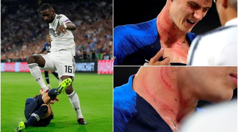 Germania-Francia: Pavard sfregiato sul collo dai tacchetti di Rüdiger