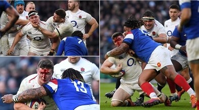 Curry colpito al volto: è una maschera di sangue!