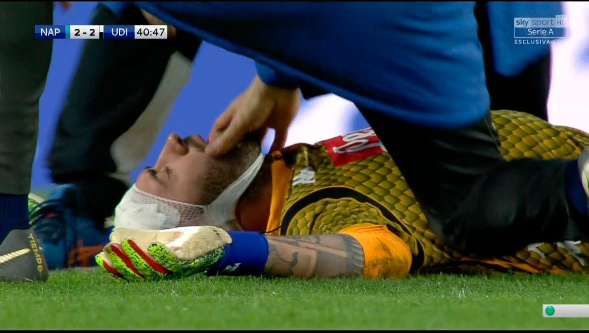 Ospina colpito alla testa, si accascia in campo: paura a Napoli