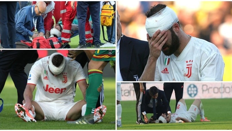 Higuain tiene in ansia la Juve: che scontro con Gabriel!