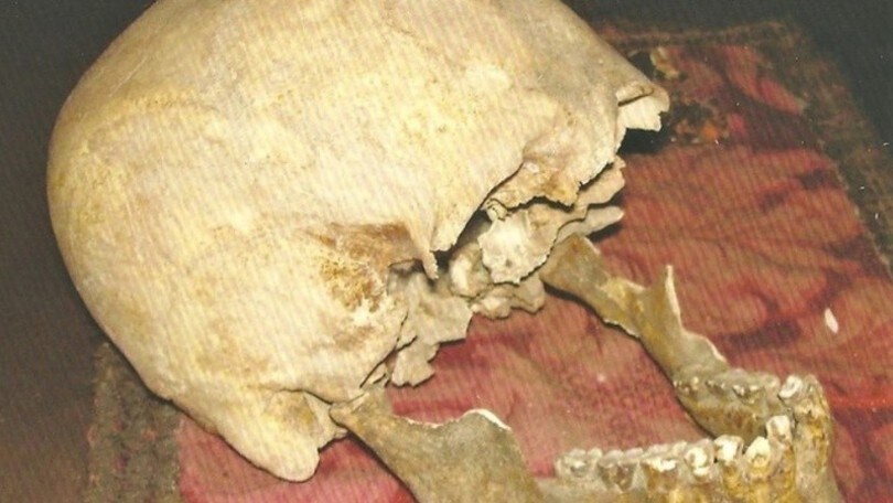 Roma, è di Plinio Il Vecchio il cranio misterioso?