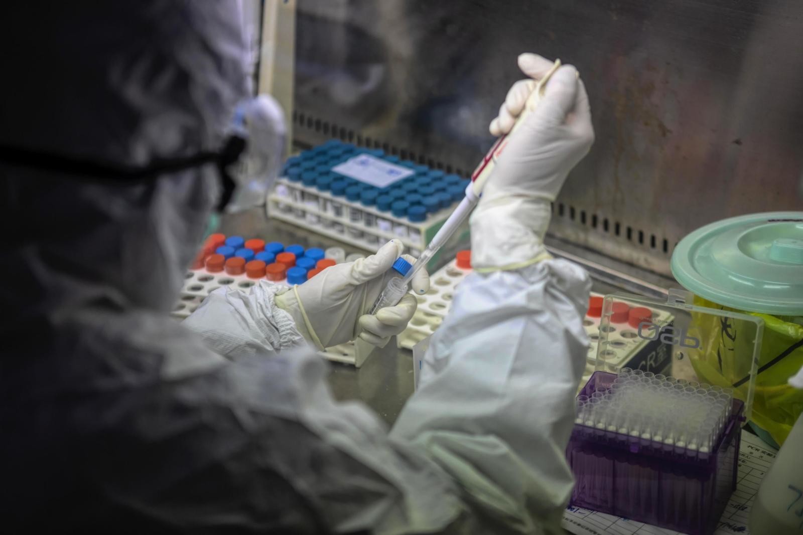 Coronavirus, donazioni di sangue in calo in tutta Italia