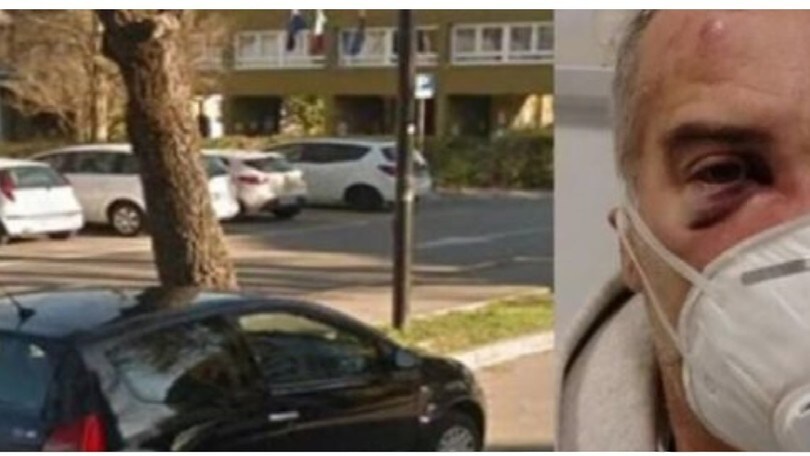 Niente mascherina, runner picchiato a sangue. Sono stati un padre e...