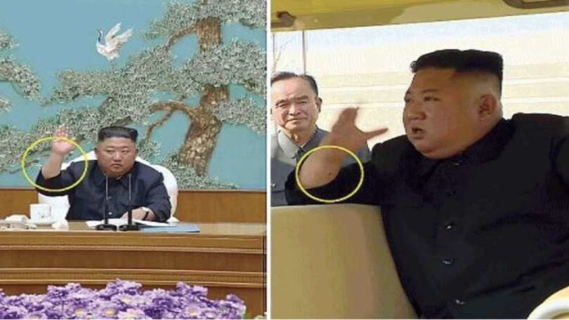 Kim Jong-un, quanti dubbi: compare una misteriosa macchia sotto al polso