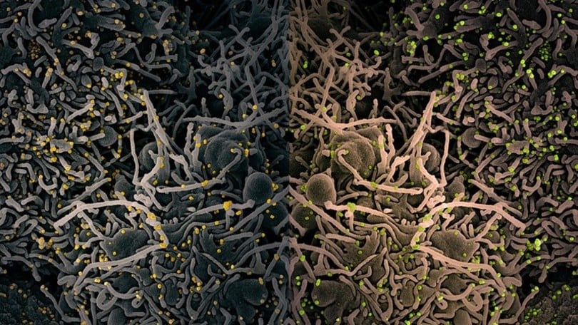 Coronavirus, ecco come vengono attaccate le cellule