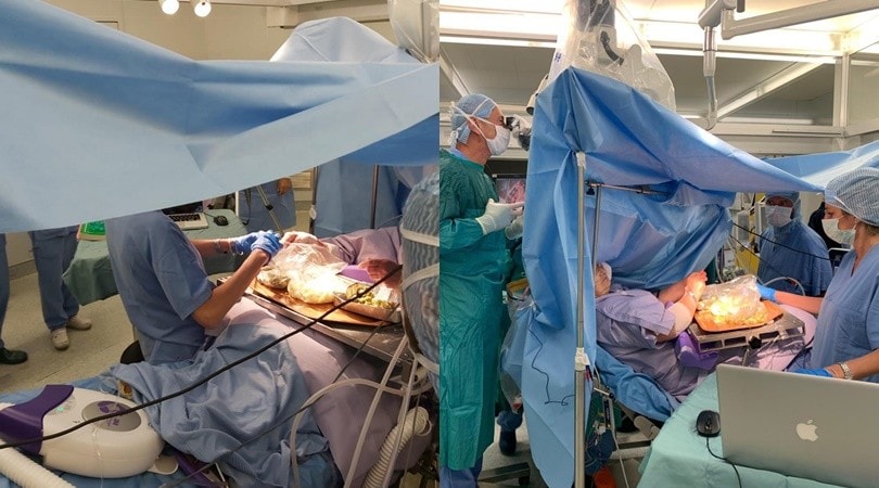 Ancona, una donna prepara 90 olive ascolane mentre viene operata al cervello