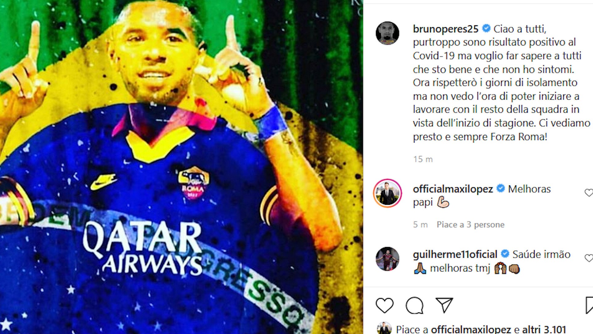 Roma, altro caso di Covid-19: è la volta di Bruno Peres