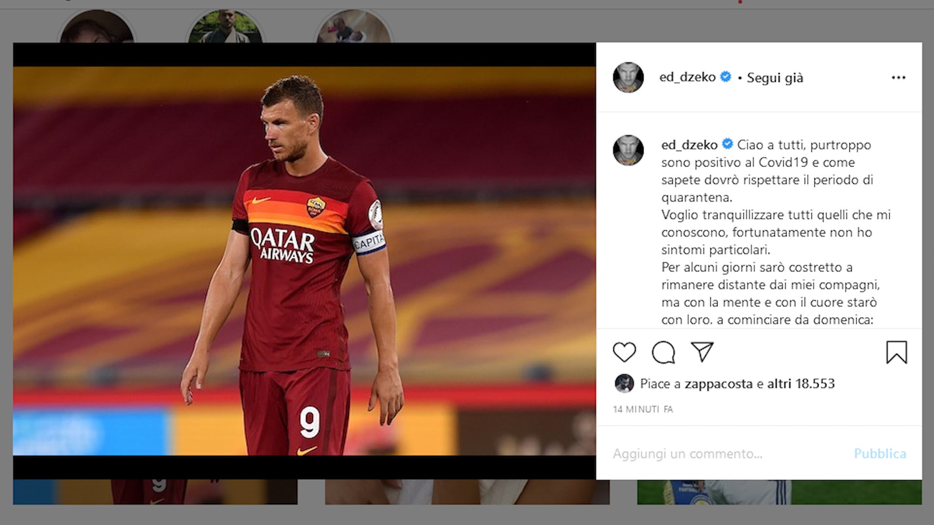 Roma, Edin Dzeko è positivo al Covid-19