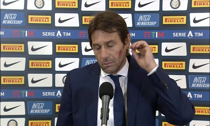Conte "innamorato di Vidal": "Soddisfatto di lui anche dovesse giocare in porta"