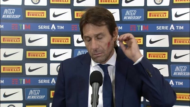 Conte "innamorato di Vidal": "Soddisfatto di lui anche dovesse giocare in porta"