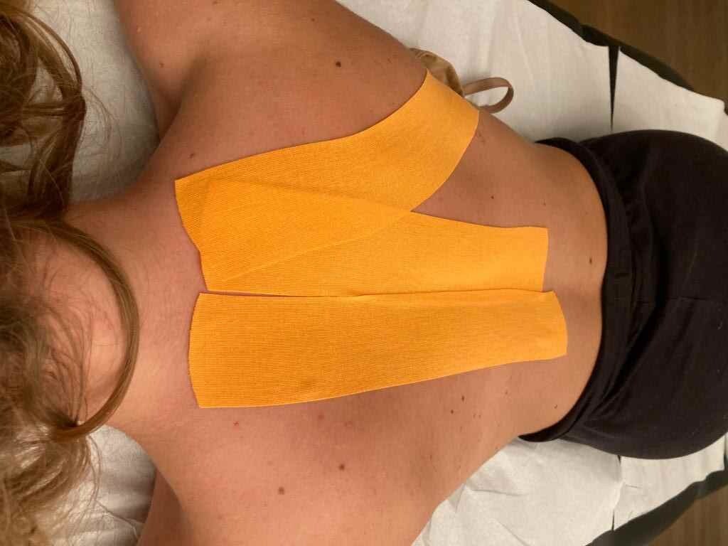E' davvero efficace il Kinesiotaping?