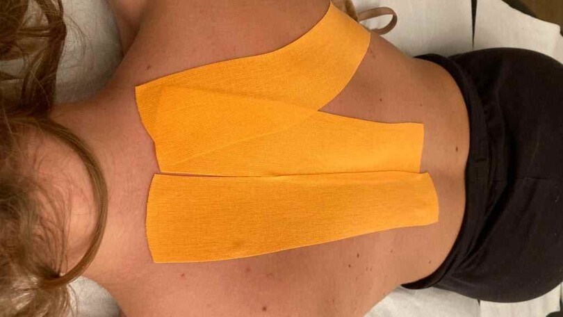 E' davvero efficace il Kinesiotaping?