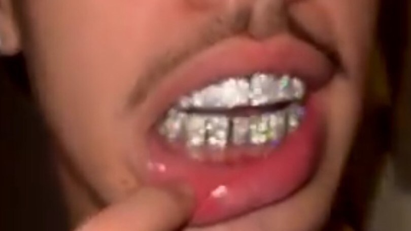 Nba, follia LaMelo Ball: denti d'oro bianco e diamanti