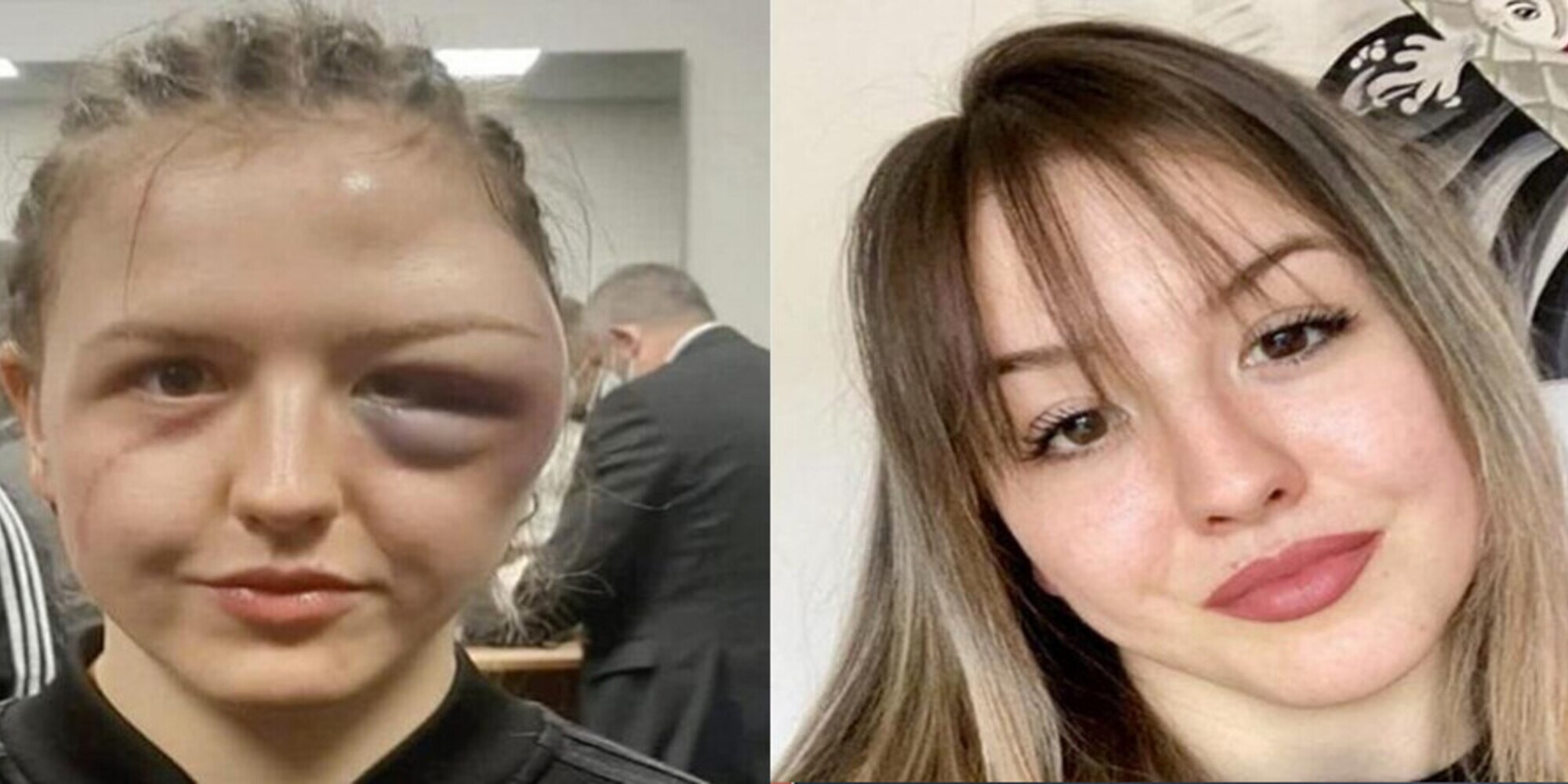 La tedesca Hanson e i devastanti colpi subiti nell'ultimo match