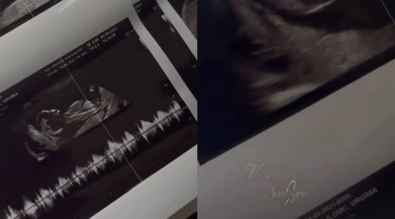 Virginia Mihajlovic mostra l'ecografia del bebè
