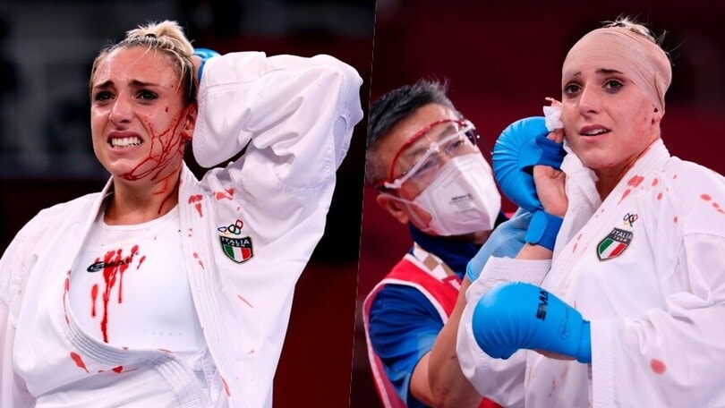 Semeraro, brutta ferita alla testa: sangue e punti di sutura