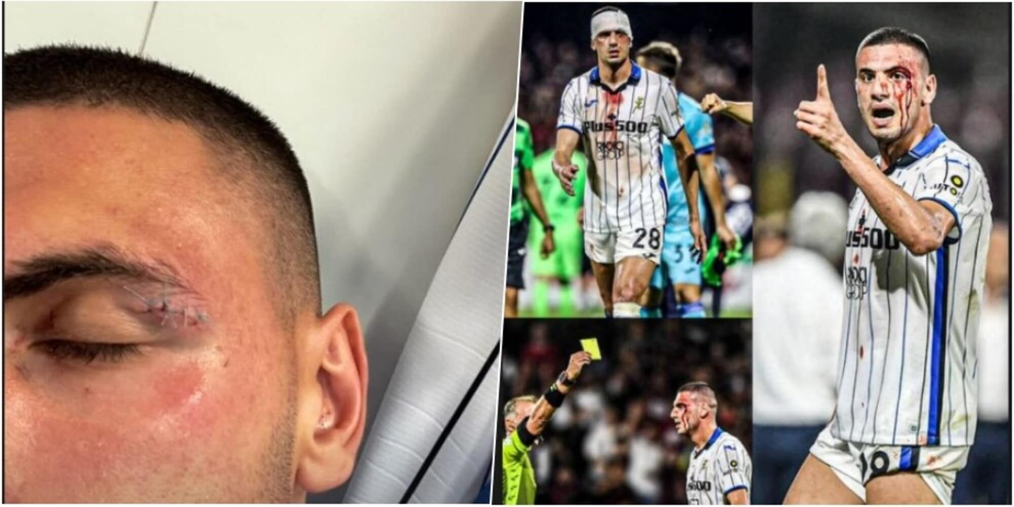 Atalanta, Demiral sbotta sui social per la gomitata di Djuric