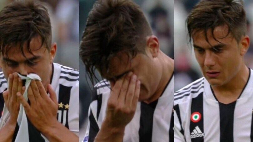 Dybala infortunato: lascia tra le lacrime Juve-Sampdoria