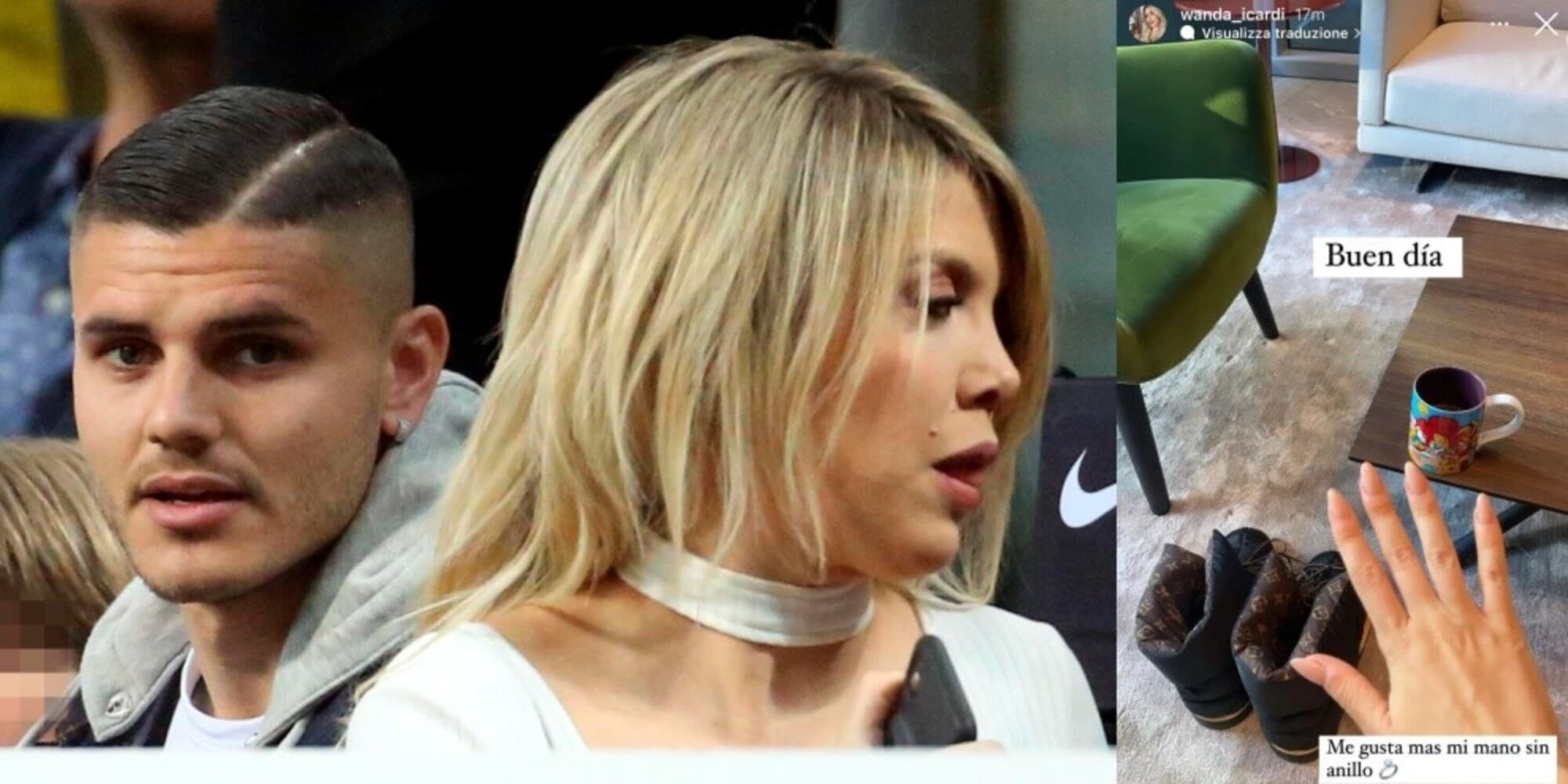 Wanda Nara: "La mia mano sta meglio senza l'anello"