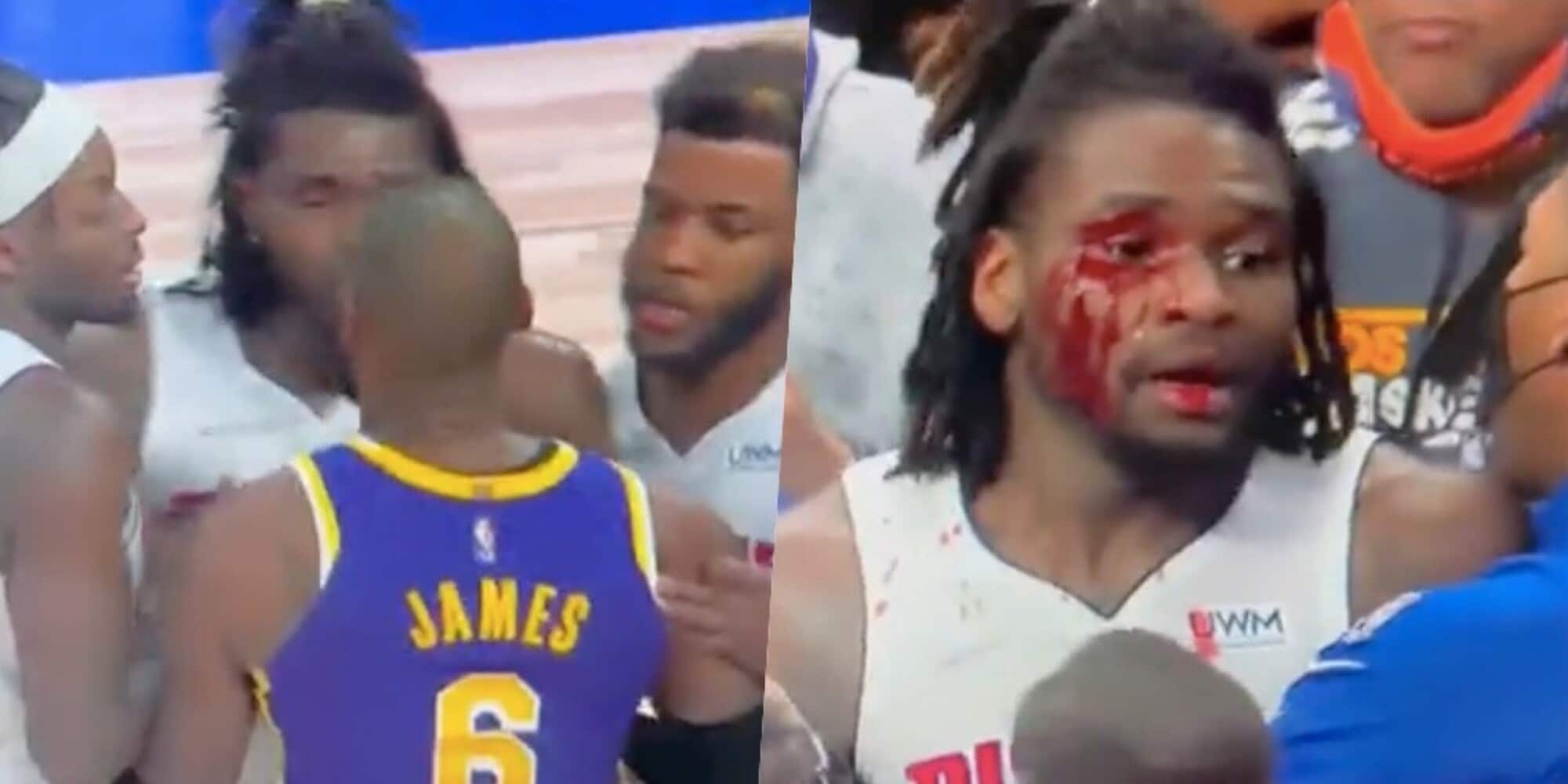 Maxi-rissa in Nba: LeBron James colpisce Stewart e viene espulso!