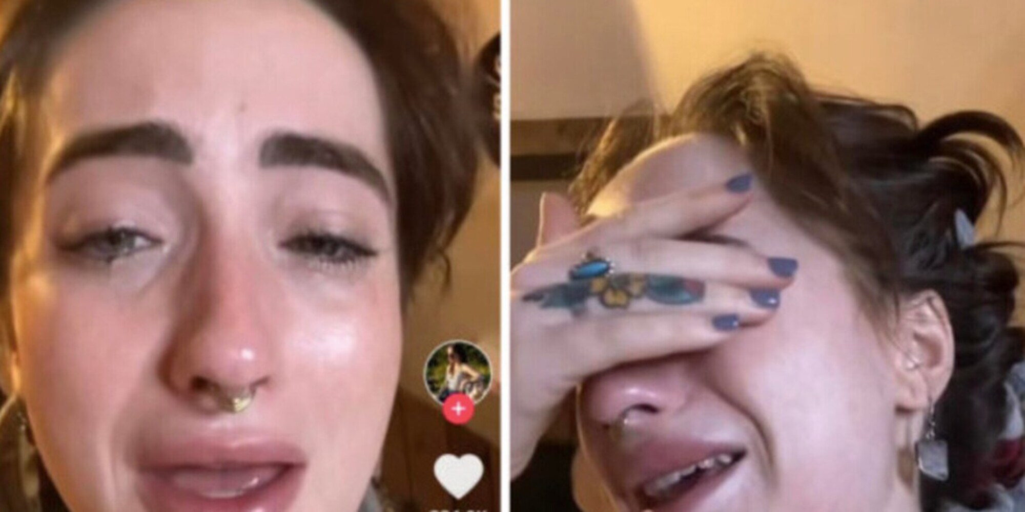 Ragazza ingoia un AirPod per sbaglio: “Continuava a funzionare”