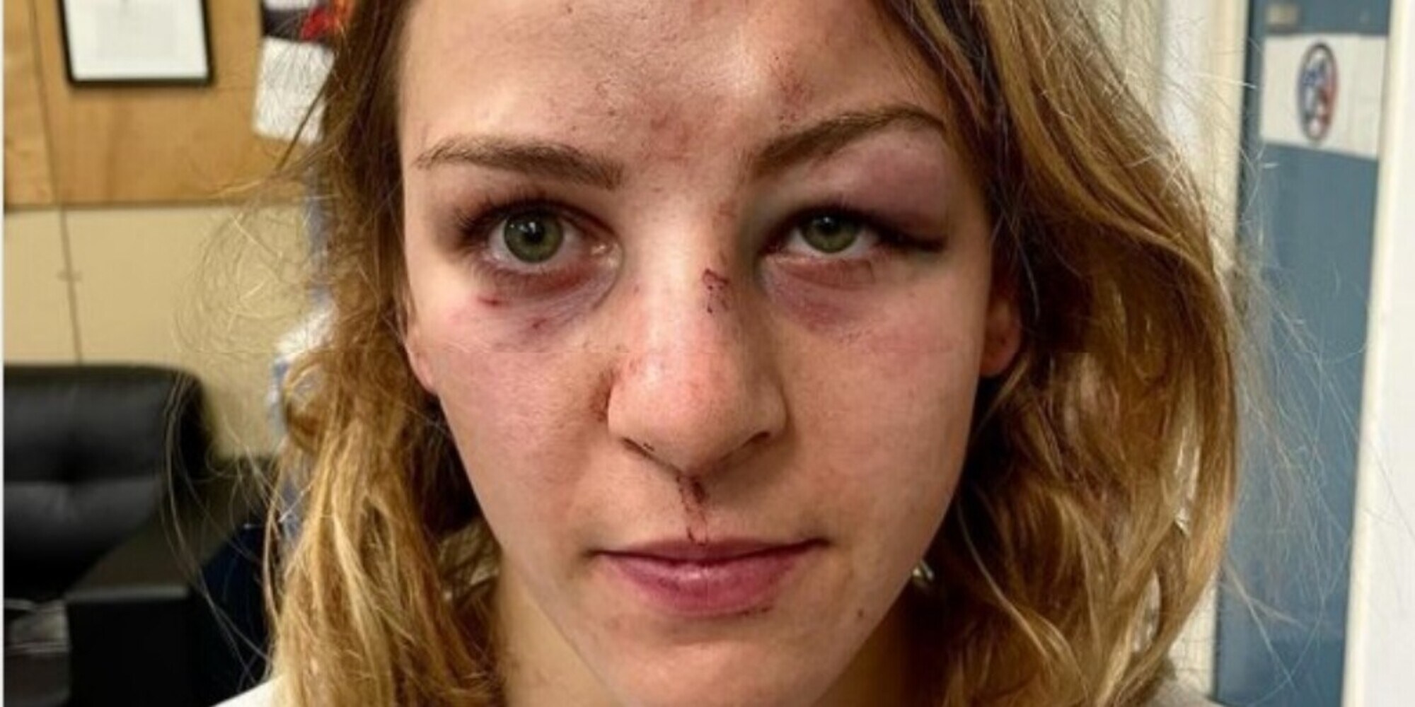 Pinot accusa di violenze il coach-compagno: il giudice lo proscioglie