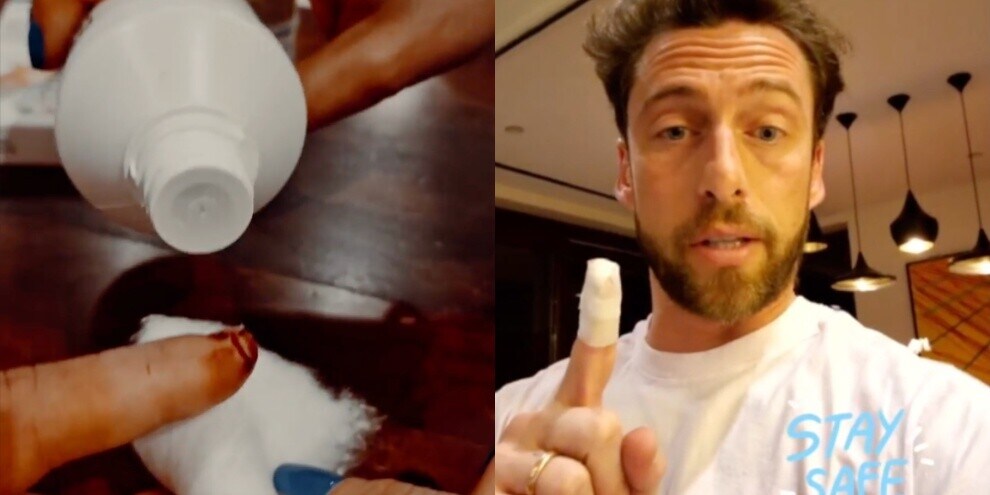 Marchisio, infortunio domestico: si taglia il dito mentre affetta il pane