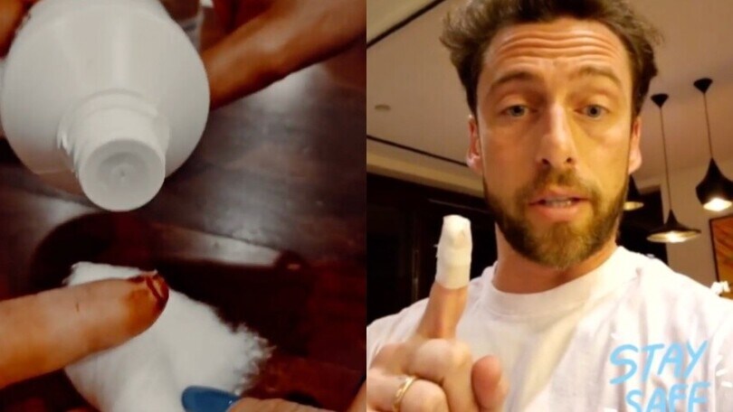 Marchisio, infortunio domestico: si taglia il dito mentre affetta il pane