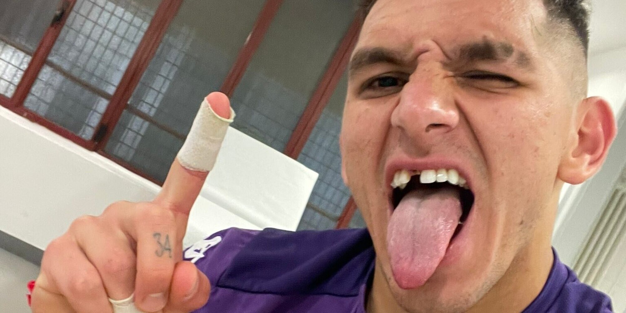Fiorentina, Torreira dà tutto contro l'Inter. Compreso un dente