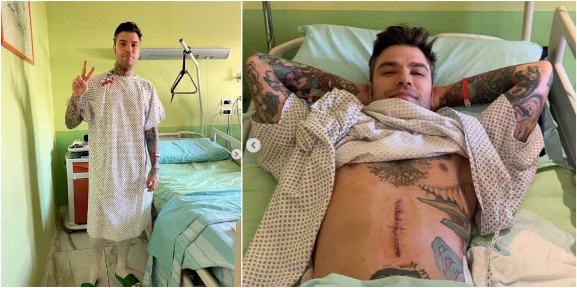 Fedez: “Operato per un tumore neuroendocrino del pancreas”