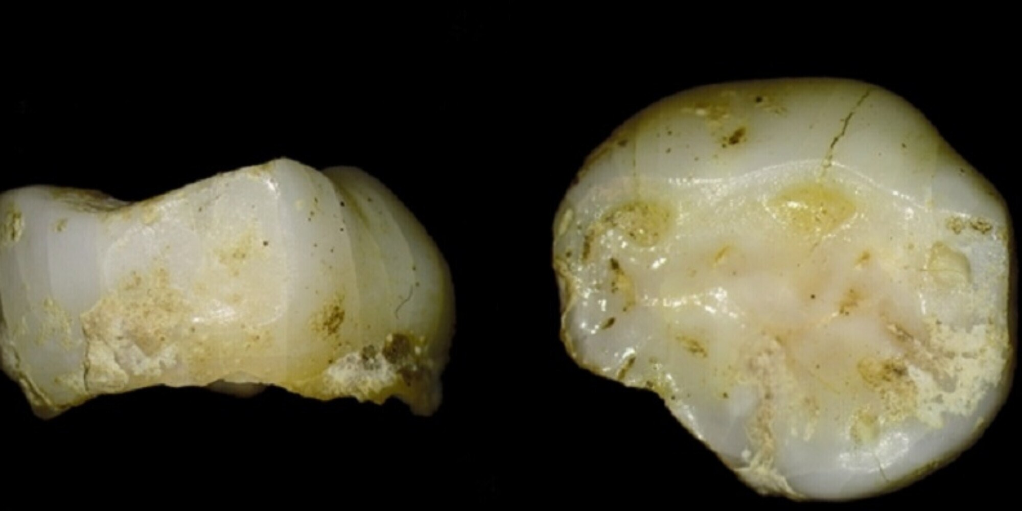 Dente di un bimbo di 13mila anni fa ritrovato sulle Prealpi Friulane