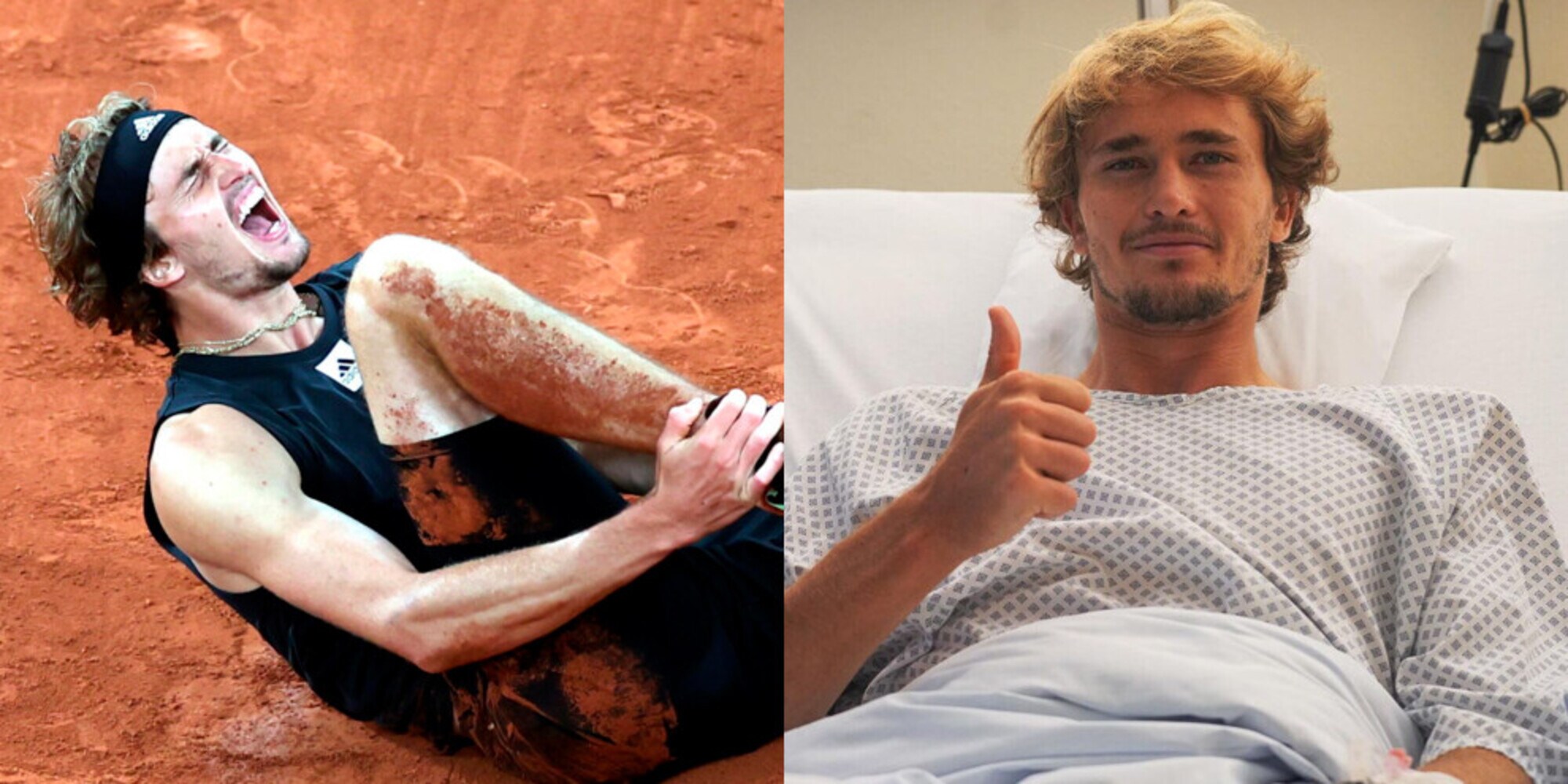 Zverev si è operato e salterà Wimbledon: "È stata la scelta migliore"