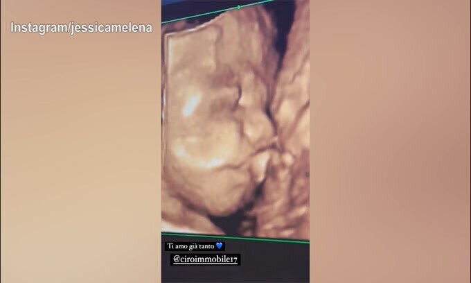Jessica e Ciro, ecco l'ecografia del bebè in arrivo