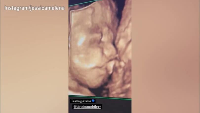 Jessica e Ciro, ecco l'ecografia del bebè in arrivo