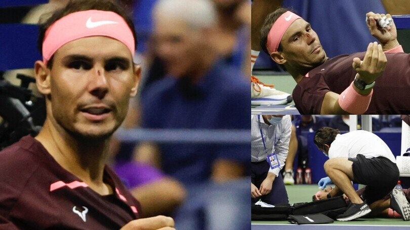 Nadal sanguina, che racchettata sul naso! Intervengono i medici