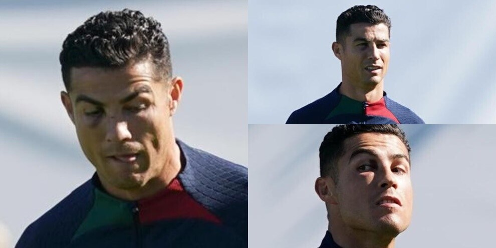 Cristiano Ronaldo porta sul volto i segni dello scontro con Vaclik