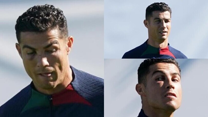 Cristiano Ronaldo porta sul volto i segni dello scontro con Vaclik