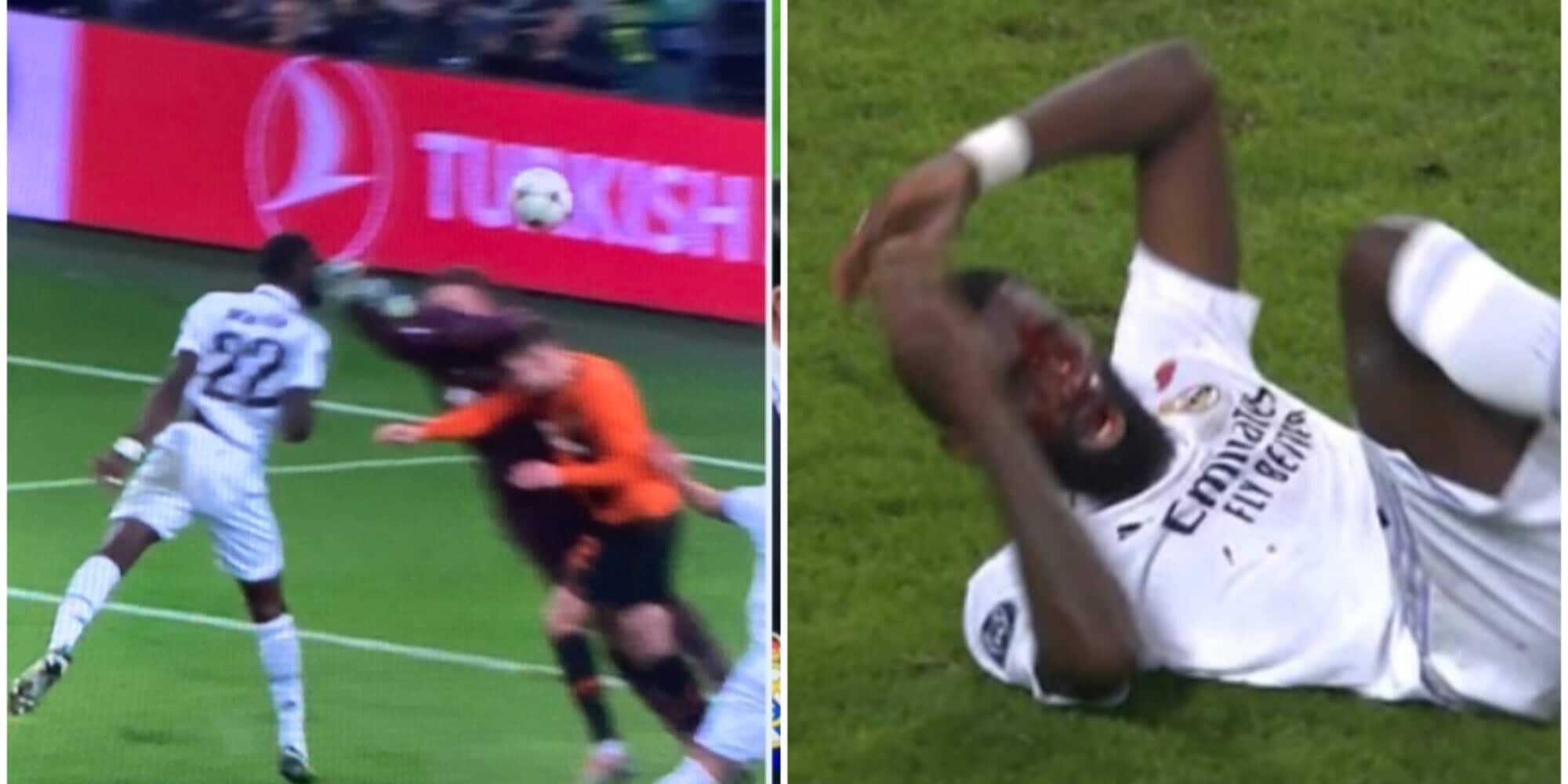 Champions, Psg-Benfica 1-1. Rudiger shock: pari al 95' e faccia spaccata!