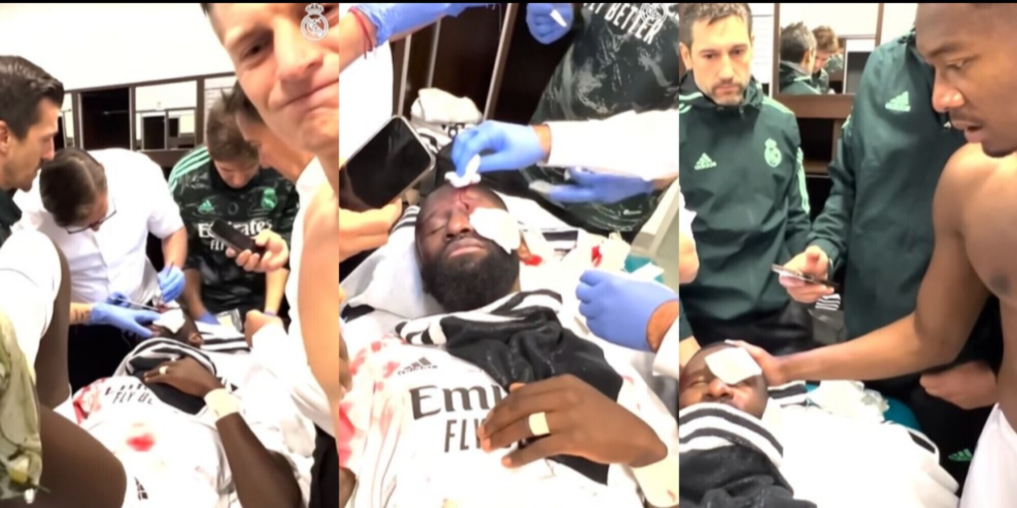 Infortunio Rudiger, immagini shock e compagni del Real Madrid terrorizzati